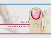 ������� � ������� (���������)