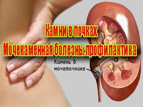 ����� � ������. ������������ �������: ������������ (2013) DVDRip