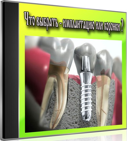 ��� ������� - ����������� ��� ������� (2013) DVDRip