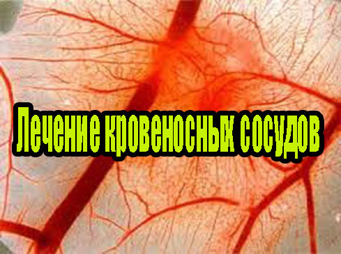 ������� ����������� ������� (2013) DVDRip